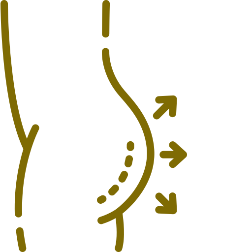 gluteo